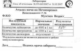 Расшифровка результатов анализа мочи по нечипоренко у детей норма и повышенное число элементов.