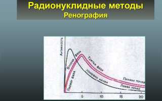 Лучевая диагностика в нефрологии и урологии