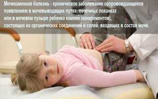 Детская урология камень в почке