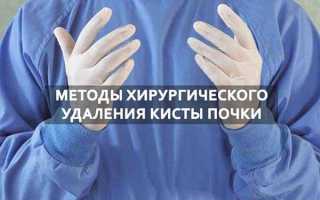 Операция по удалению кисты почки, особенности лапароскопического метода