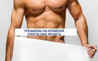 Трещины на крайней плоти — причины, лечение и осложнения