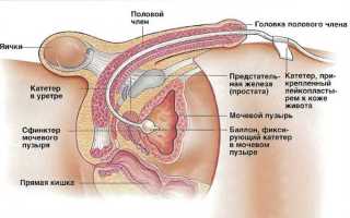 Катеджель с лидокаином – инструкция по применению геля, цена, отзывы