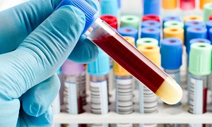 Сколько действительны анализы на ВИЧ и гепатит: сдача крови перед операцией и госпитализацией, какие анализы нужно сдать для оформления медкнижки